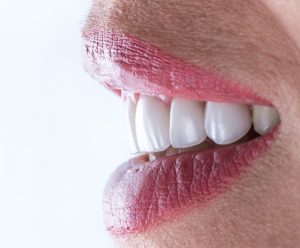 Zdjęcie uśmiechu pacjenta po wykonaniu zabiegu stomatologii estetycznej